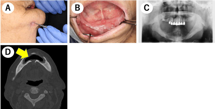 Figure 6