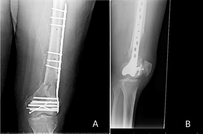Figure 1