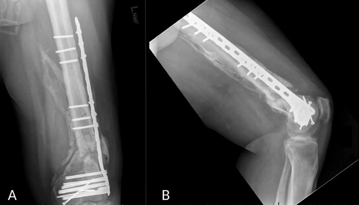 Figure 2