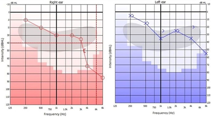 Figure 2