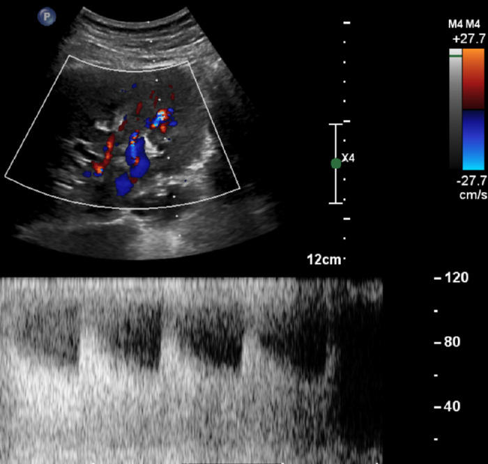 Figure 1