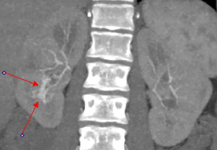 Figure 2