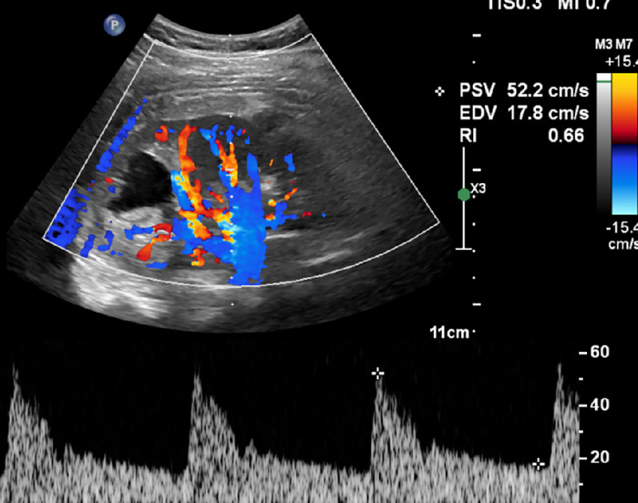 Figure 4