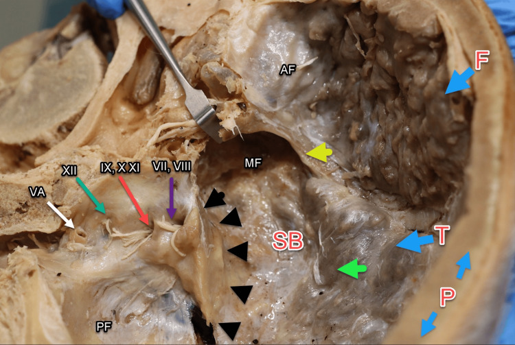 Figure 9