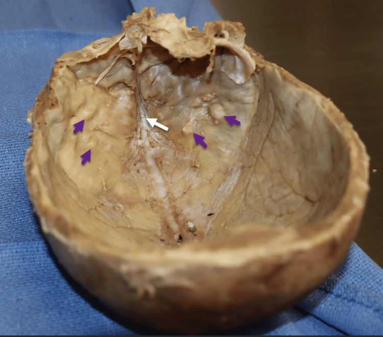 Figure 10