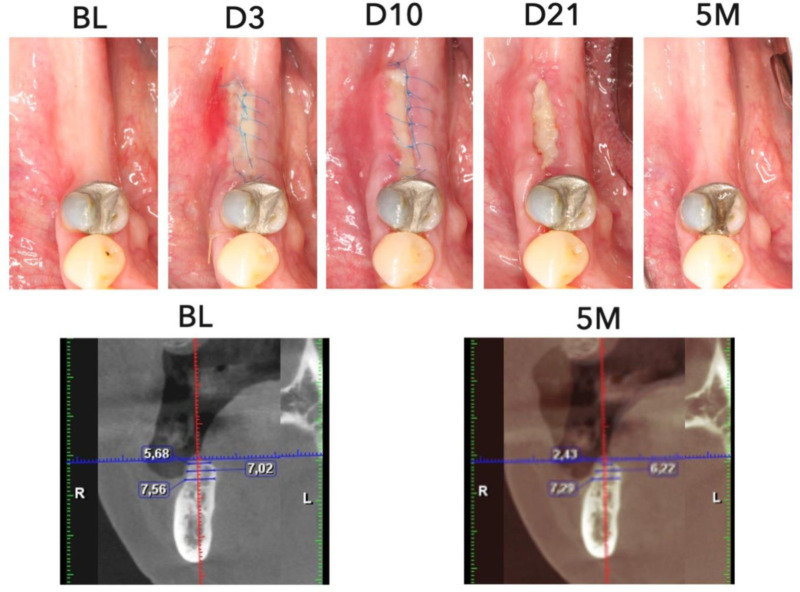 Fig 4