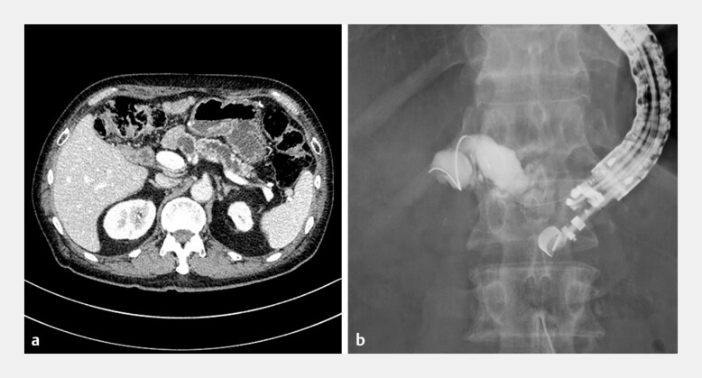 Fig. 1