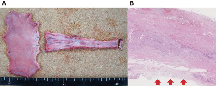 Fig. 5