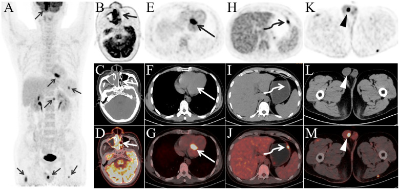Figure 1