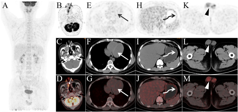 Figure 2