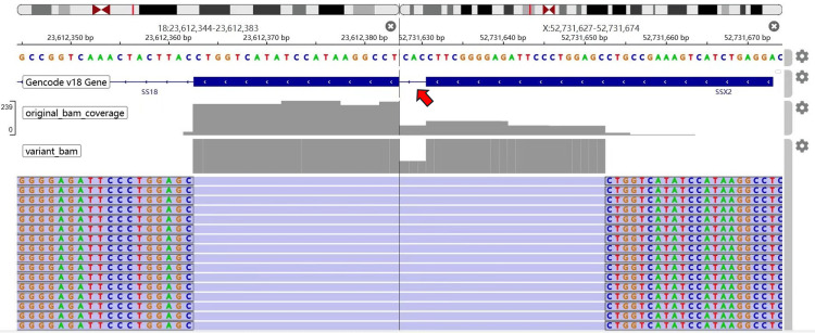 Figure 4