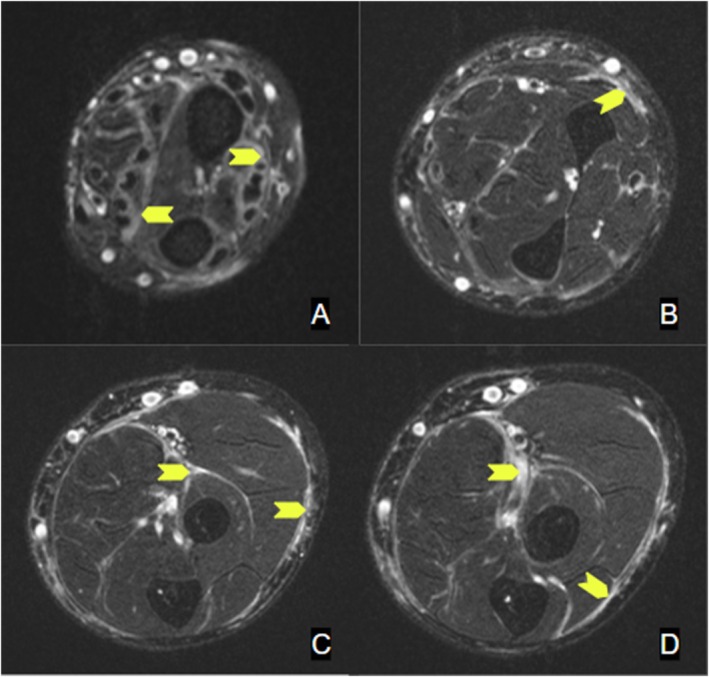 FIGURE 4
