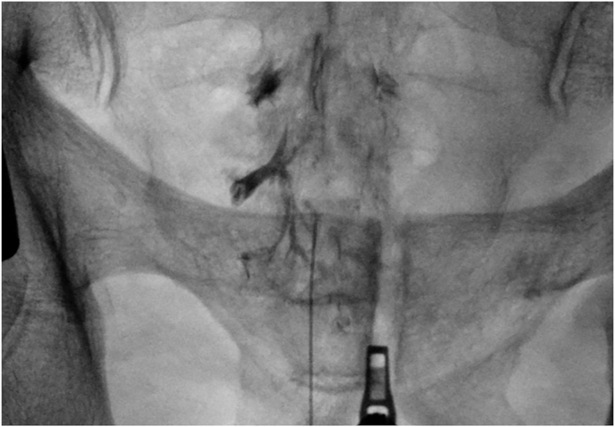 Figure 6