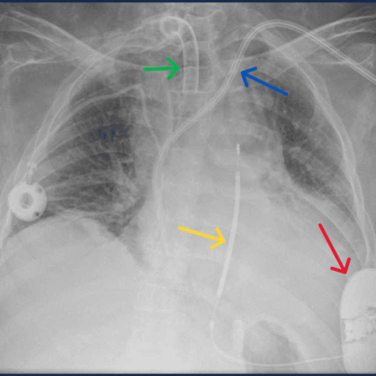 Figure 5