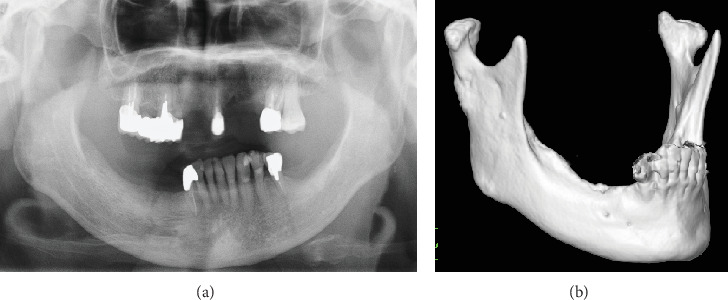 Figure 7