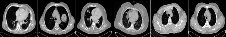 Figure 17
