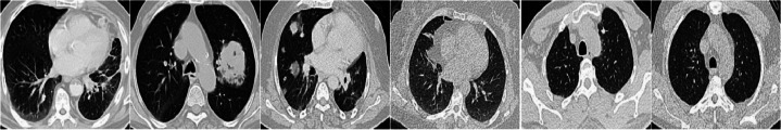 Figure 18