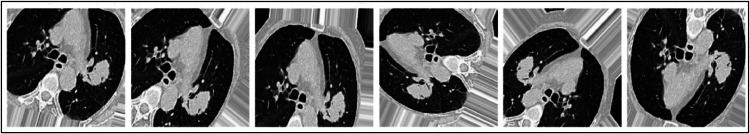 Figure 20