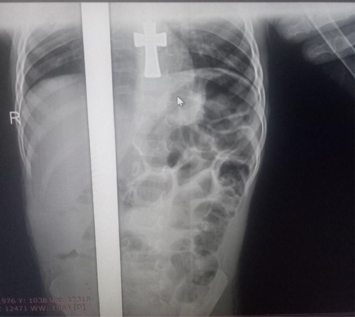 Figure 5