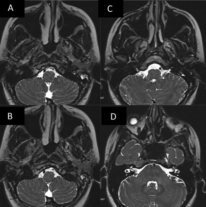 FIGURE 4