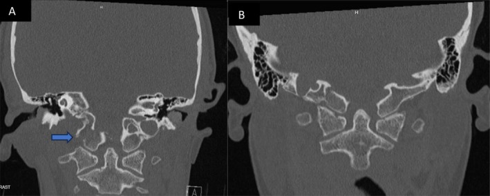 FIGURE 1
