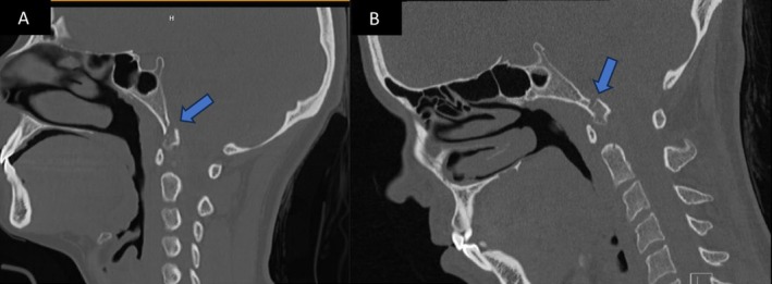 FIGURE 2