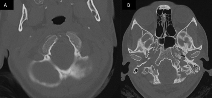 FIGURE 3