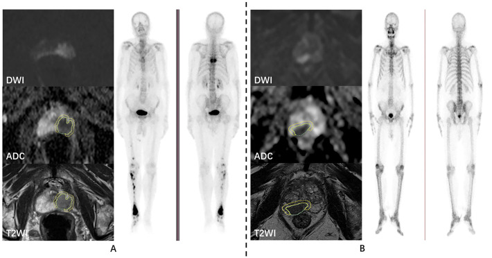 Figure 2