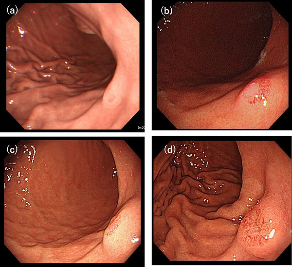 FIGURE 1