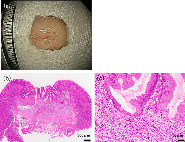 FIGURE 3