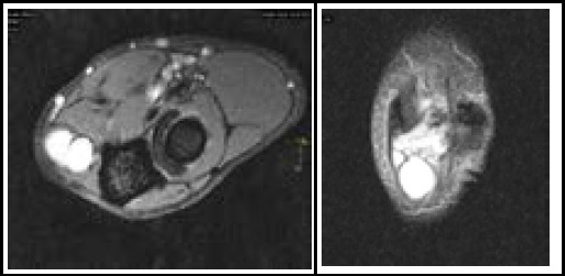 Figure 2a and 2b
