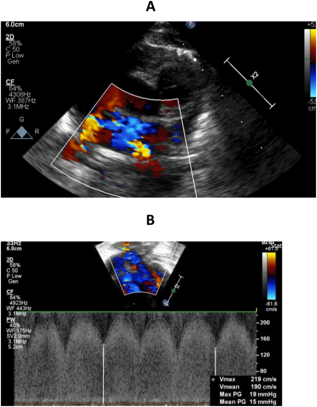 Figure 1