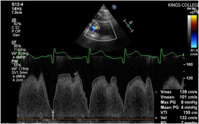 Figure 2