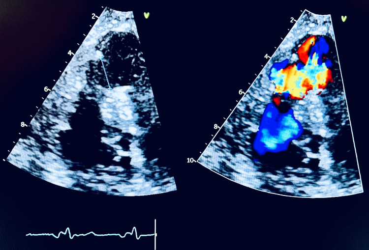 Figure 2