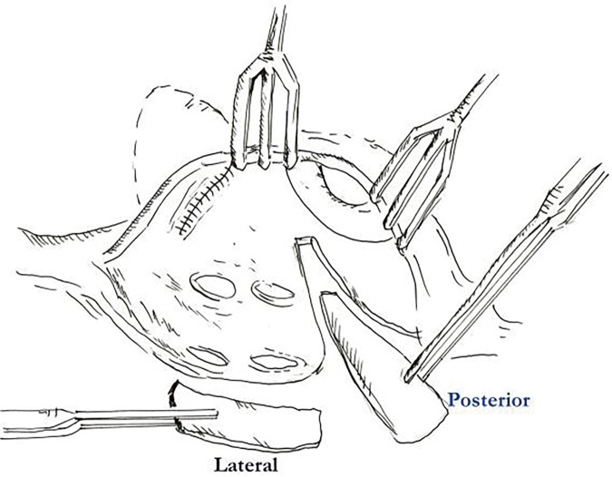 Fig. 2