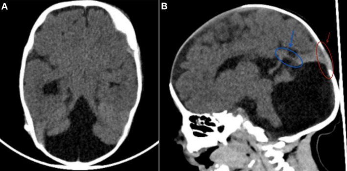 FIGURE 1