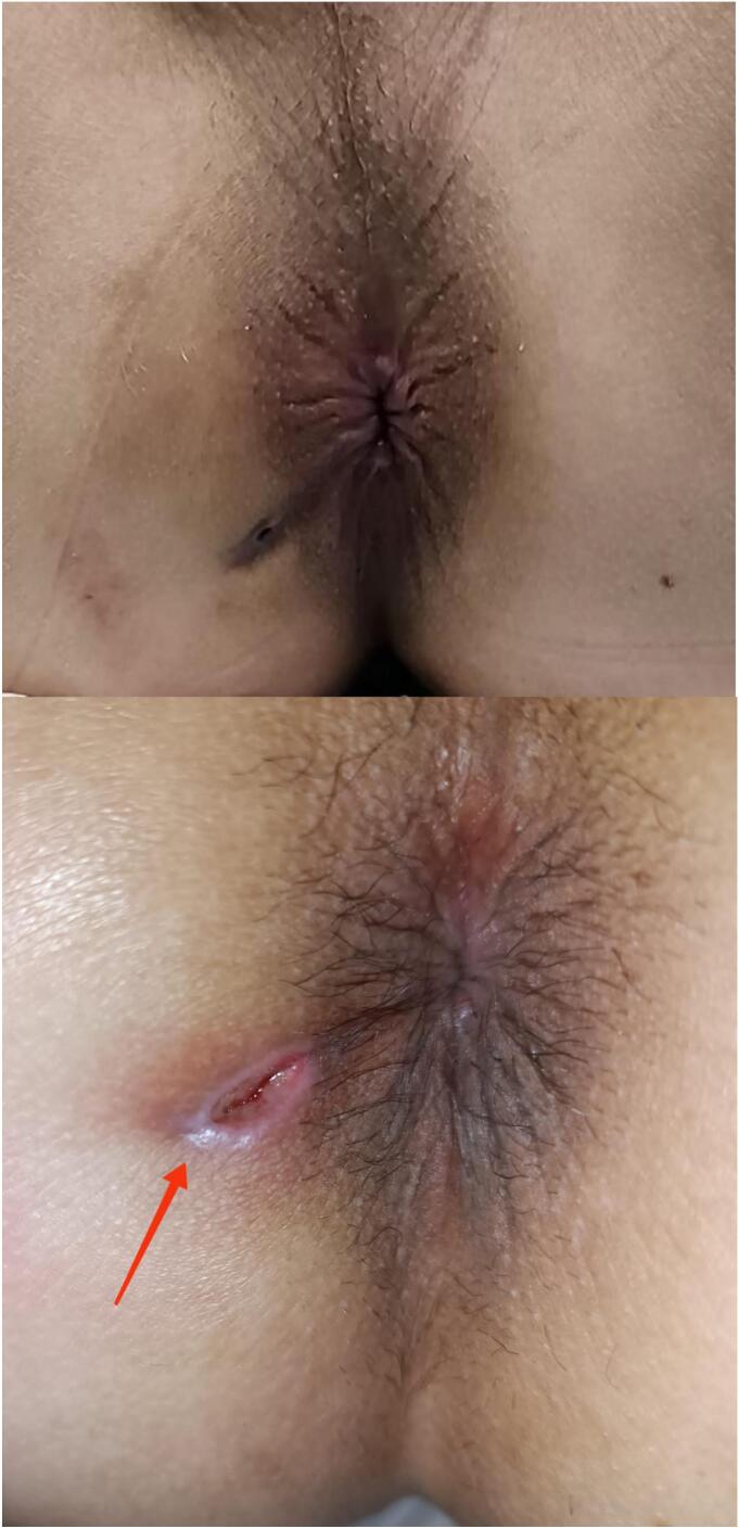 Figure 4