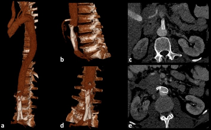 FIGURE 4