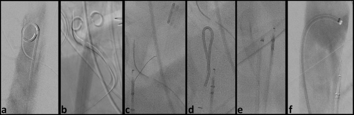 FIGURE 3