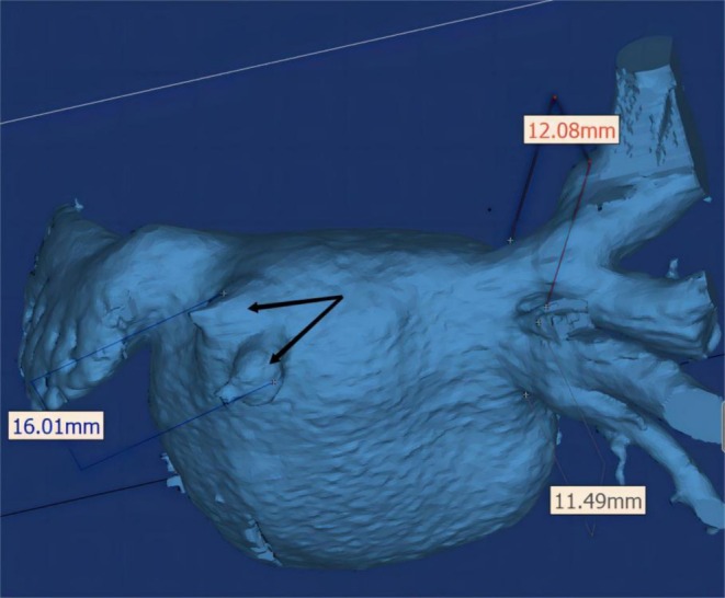 FIGURE 1
