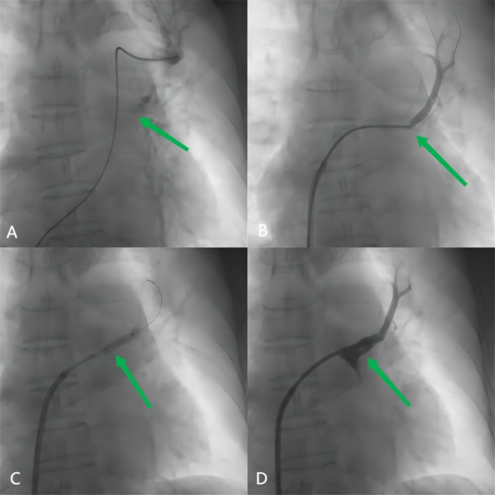 FIGURE 3