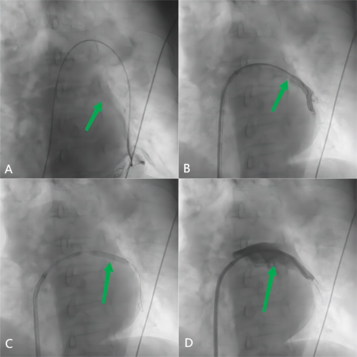 FIGURE 2