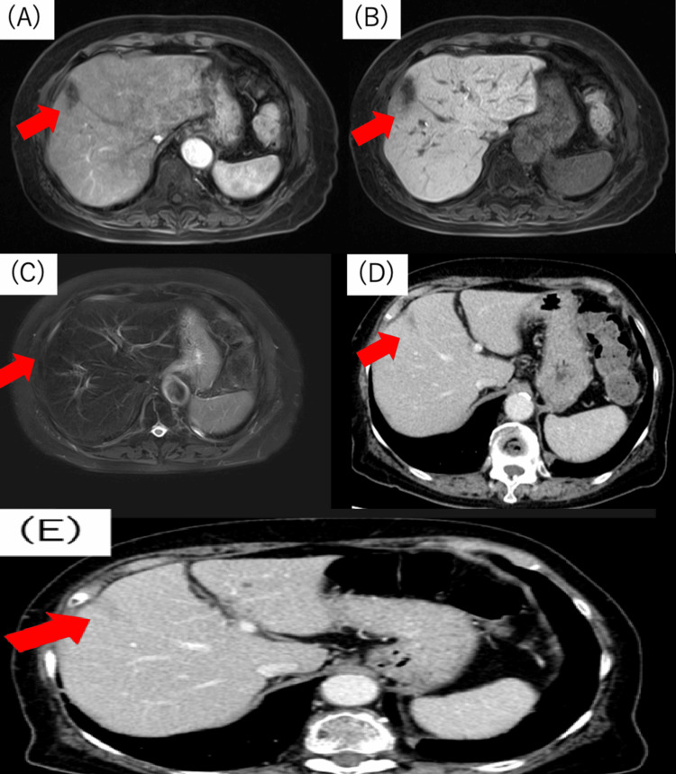 Figure 5