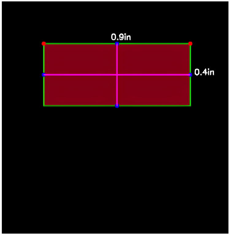 Figure 17