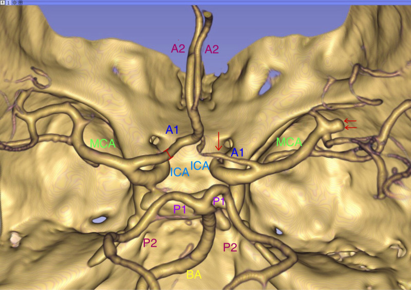 Figure 3