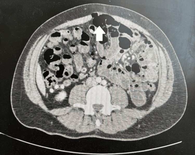 Figure 7