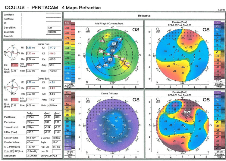 Figure 2