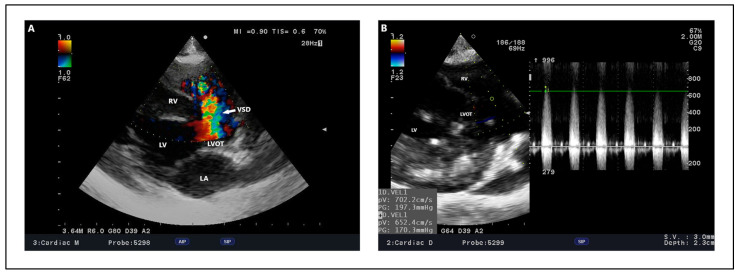 Figure 9