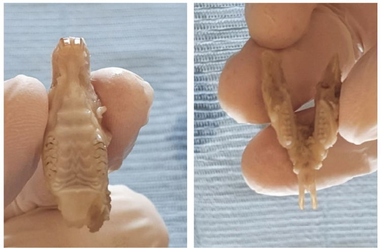 Figure 2