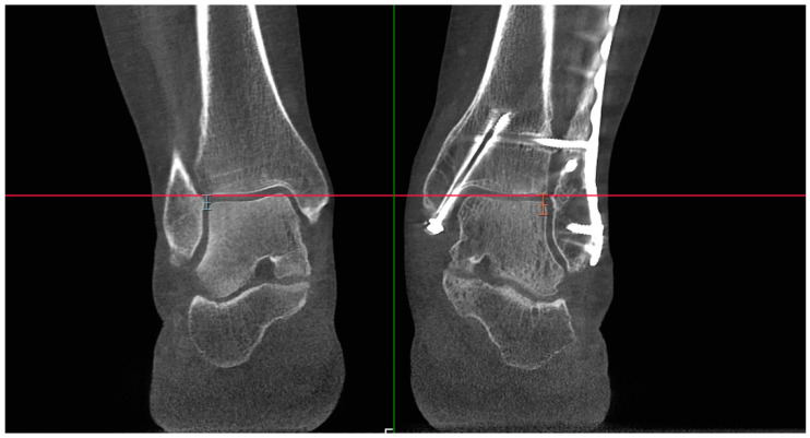 Figure 6